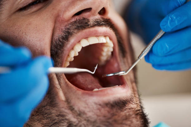 Oral Cancer Screening in Accokeek, MD